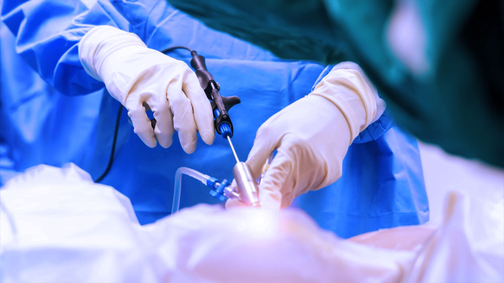 Endoscopic Spine Surgery