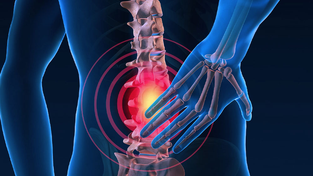Lumbar Micordiscectomy