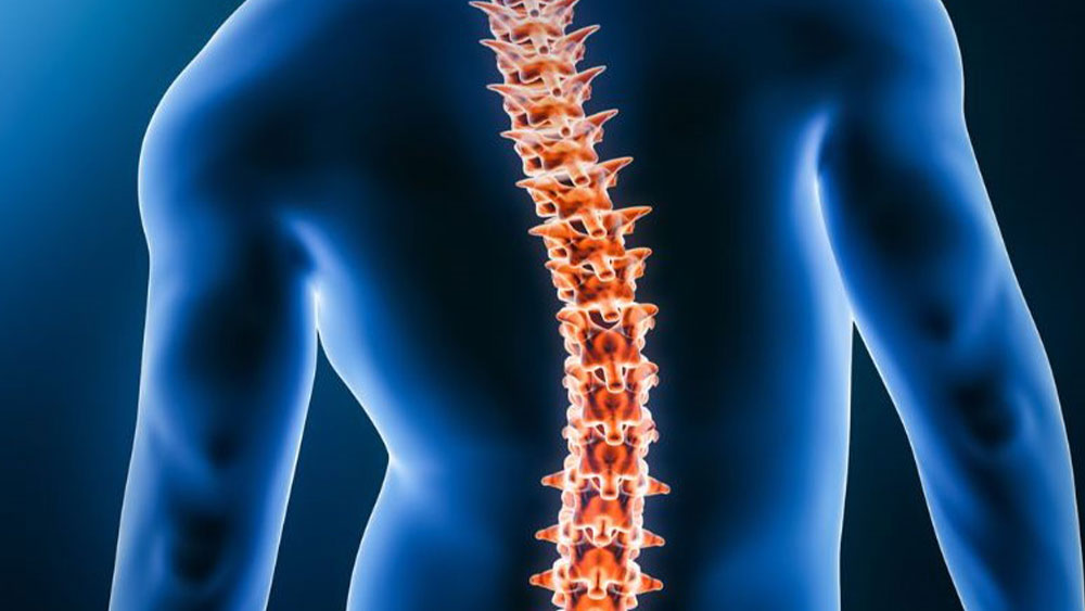 Scoliosis